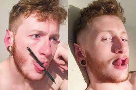 Man Explains What It Feels Like To Have Your Tongue Split Metro News