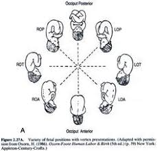 Fetal Heart Monitoring Mneumonic Google Search Labor Nurse Neonatal Nurse Child Nursing