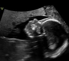 Maybe you would like to learn more about one of these? Galleries Wee Beginnings 3d 4d Ultrasound