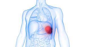 We did not find results for: Penyebab Posisi Organ Limpa Berpindah Tempat