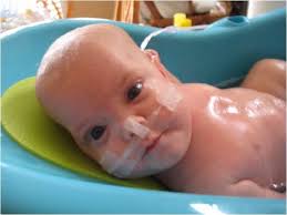 When a baby breathes in, they get a mixture of room air and oxygen from the nasal cannula. Tips For Babies Going Home On Oxygen