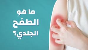 اعراض مرض الايدز youtube