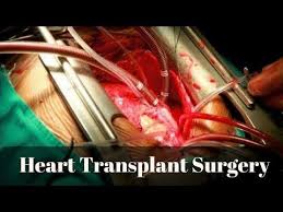 Heart Transplant Surgery Youtube Heart Transplant Heart Surgery Open Heart Surgery
