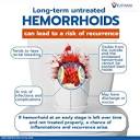 Long-term untreated Hemorrhoids can lead to a risk of recurrence ...