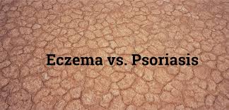 We did not find results for: Eczema Vs Psoriasis What You Need To Know Ceradan