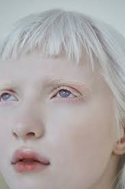 Lookbook For Deepflow Albino Girl Albino Model Portrait