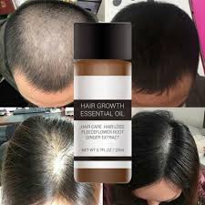 Wake up your hair follicles with head massage. Clearance Best Organic Hair Growth Oils With Tea Tree Stop Hair Loss Now By Hair Thickness Maximizer Best Treatment For Hair Thinning Hair Thickening Serum Walmart Com Walmart Com