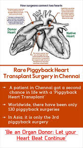 Über 7 millionen englischsprachige bücher. Piggyback Heart Transplant Procedure In Chennai Interview With Dr Ejaz Ahmed Sheriff