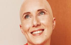 haarausfall bei chemo oncovia