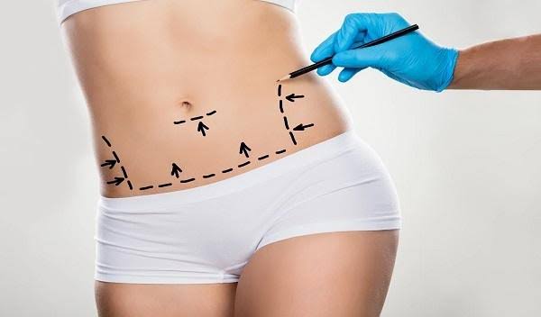 Tummy Tuck Surgery in Islamabad, Rawalpindi &amp;amp; Pakistan
