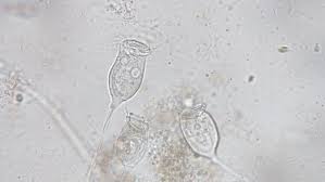 Where can you find protozoans in fresh water? Living Vorticella Is A Genus Stock Footage Video 100 Royalty Free 20902027 Shutterstock