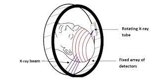 How To Interpret An Unenhanced Ct Brain Scan Part 1 Basic Principles Of Computed Tomography And Relevant Neuroanatomy