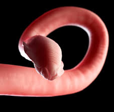 Die biologie ist eine naturwissenschaft, die sich mit den lebewesen befasst. Infektion Arzte Ziehen 2 8 Meter Langen Bandwurm Aus Patienten Welt