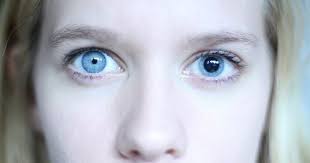 Image result for Mydriasis