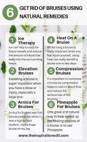 Ways To Get Rid Of Bruises Using Natural Remedies · The Inspiration Edit