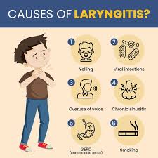 Image result for Acute Laryngitis