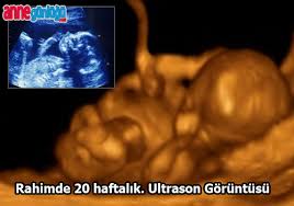 ultrasonda bebek ne zaman gorulur anne gunlugu