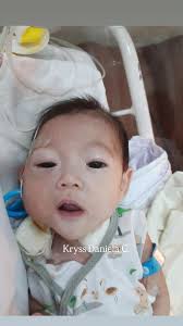 Hello, I'm from the Philippines and my mom just recently got admitted to  the hospital because of her chronic kidney disease which led to a heart  failure causing her to have to