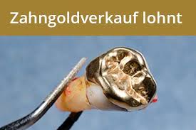 750er Goldpreis In Gramm Vergleichen