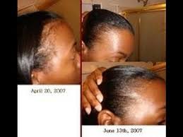 * deeply condition and moisturize hair an. Before You Use Potent Jamaican Black Castor Oil Benefits For Hair Growth Hair Loss Alopecia Youtube