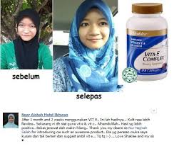 Vitamin c shaklee, vitamin c terbaik di malaysia whatsapp click bit.ly/kaknurulshaklee kenapa saya memilih vitamin c. Nor Ruzanna Hanee On Twitter Testimoni Pengguna Vitamin E Shaklee Promodec 14 Id 908559 012 5932706 Http T Co Xcqerbkz0f