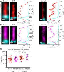 In probability theory and statistics, the weibull distribution /ˈveɪbʊl/ is a continuous probability distribution. Superresolution Microscopy Reveals Photoreceptor Specific Subciliary Location And Function Of Cep290 Biorxiv