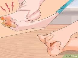 Trench foot is a type of foot damage due to moisture. How To Treat Trench Foot 11 Steps With Pictures Wikihow