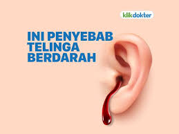 Assalamu'alaikum dok dok saya mau nanya saya hidung sebelah kiri saya berdarah tapi campur lendir/ingus sebelumnya saya blum pernah mengalai hal seperti ini ketika saya melakukan. Telinga Berdarah Ini Penyebab Dan Cara Mengatasinya