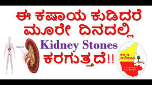 How To Remove Kidney Stones Naturally At Home Kannada Kannada Sanjeevani Youtube