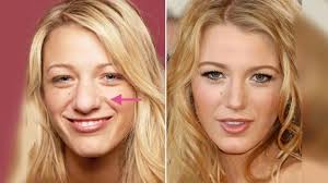 Die nasenwände sollen in den hintergrund rücken, deshalb müssen diese dunkler sein als der nasenrücken. Pin Auf Not Ugly Just Poor