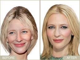 Pin On Nip And Tuck Famous Cosmetic Surgeries Photoshop Or Vulgar Stuff From The People