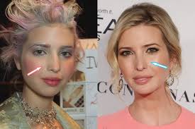 Ivanka Trump Plastic Surgery Revealed Before After Photos In 2021 Ivanka Trump Style Ivanka Trump Celebrity Plastic Surgery