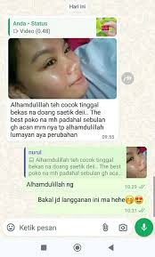 💖 Manfaat Daisy Perfect Cream 1. Membantu Mengecilkan pori pori 2.  Mencerahkan wajah 3. Menghilangkan flek hitam dan bekas jerawat 4. Membantu  menyembuhkan jerawat 5. Membuat wajah glowing natural 6. Meratakan warna