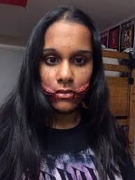 A glasgow smile (also known as a glasgow, chelsea, or cheshire grin) is a wound caused by making small cuts on the corners of a victim's mouth, then beating or stabbing him or her until the muscles in the face contract, causing the cuts to this leaves a scar in the shape of a smile, hence the name. Chelsea Smile Special Effects Makeup Amino