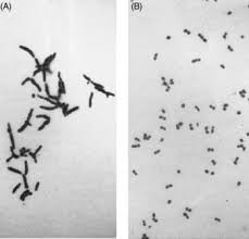 Image result for Rhodococcus equi