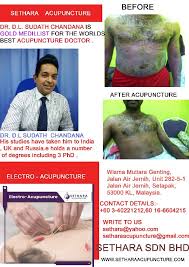 By jane grissmer, mac, dipl. Sethara Acupuncture In Kuala Lumpur Malaysia Read 1 Review