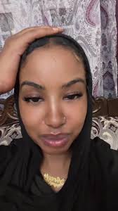 Exposure Therapy Day 1: A Fun Journey