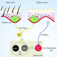 Treatment of merkel cell carcinoma. Iasp On Twitter Read Painresearchforum S When Touch Causes Itch A New Role For Merkel Cells In The Skin Https T Co Uzuwzhqnfb Did You Hear A Recent Mouse Study Identifies Cells That Regulate Alloknesis Through