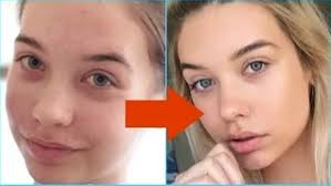 Amanda Steele Reveals How She Got Rid Of Acne In Super-Honest Video