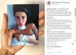 Ha dichiarato valentina vignali a pomeriggio 5, durante un acceso confronto con chi assicurava che per guarire dal tumore è necessario cambiare soltanto l'alimentazione. Valentina Vignali Cosi Ho Sconfitto Il Cancro