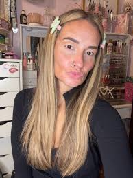 Transforming Smiles with Dental Implants and Bridges