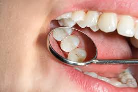 Preventing Cavities In Your Child's Smile | Richfield, MN