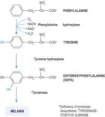 Albinism An Overview Sciencedirect Topics