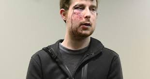 Bond reduced for chase suspect; Deputy placed