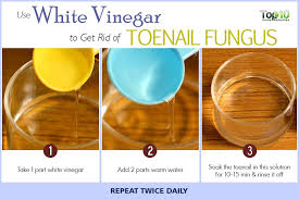 Soak your toenail within this solution for half an hour daily. 10 Remedies To Fight Toenail Fungus At Home Top 10 Home Remedies