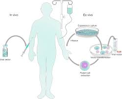 Jul 12, 2019 · how does the image support the text? Viral Vector Platforms Within The Gene Therapy Landscape Signal Transduction And Targeted Therapy