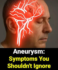 Misdiagnosed ruptured brain aneurysm symptoms