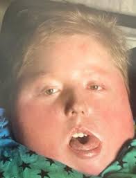 Luke Mark Ladendorf Obituary