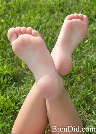 Trench foot is a type of foot damage due to moisture. How I Use Tea Tree Oil To Treat Tinea Pedis Athletes Foot Bren Did