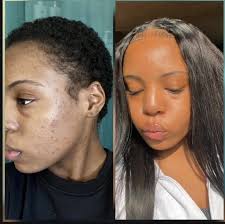 Grand Rising World Im so proud of my little cousin Issys Moore trusting me  to giving our skincare product line a try and her skin is glowing. Keep  growing and glowing beautiful love you ...